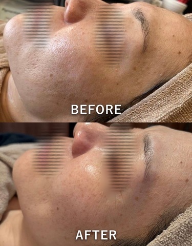 肌質が変わった・・・！